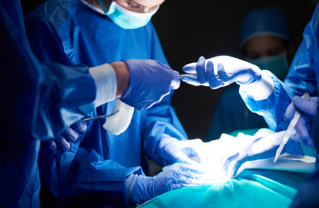 Laparoscopic Appendicectomy