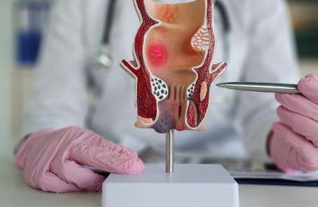 Testicular Surgeries
