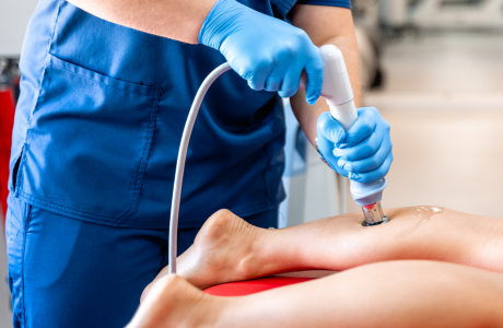 Laser or Open Fistula Repair